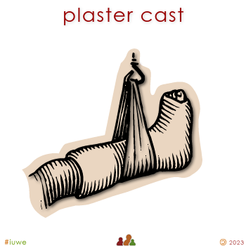 w02965_01 plaster cast