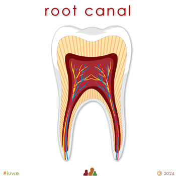 w33996_01 root canal