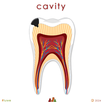 w33994_01 cavity