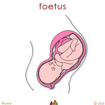 w01511_01 foetus