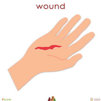 z32655_01 wound