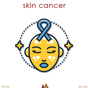 w33838_01 skin cancer